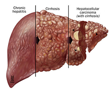 What does the drug stanozolol do