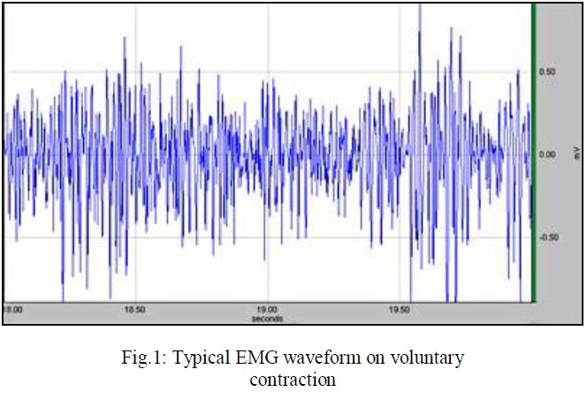EMG waveform