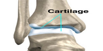 Cartilage - Assignment Point