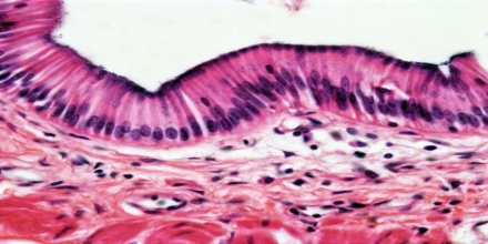 Epithelium - Assignment Point