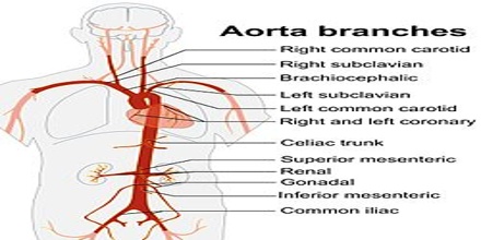 Aorta Artery Branches