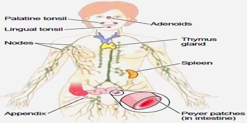 Lymphatic System Disorder - Assignment Point