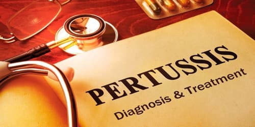 Pertussis  Assignment Point