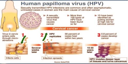 human papillomavirus infection effect