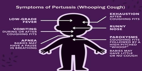 pertussis cough whooping symptoms causes coughing sign symptom disease complications side severe