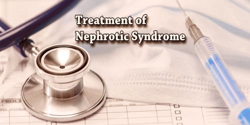 Nephrotic Syndrome Assignment Point