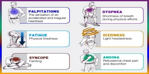 symptoms atrial fibrillation