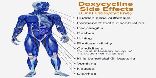Doxycycline (Uses and Effects) - Assignment Point