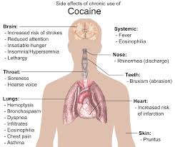 Causes and Effects of Youth Cocaine Abuse