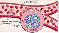 About Anemia