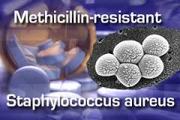 Methicillin Resistant Staphylococcus Aureus