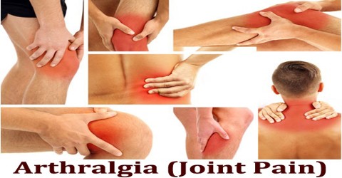 arthralgia symptoms