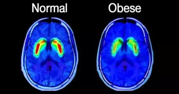 Obesity Risk is Revealed by the Brain