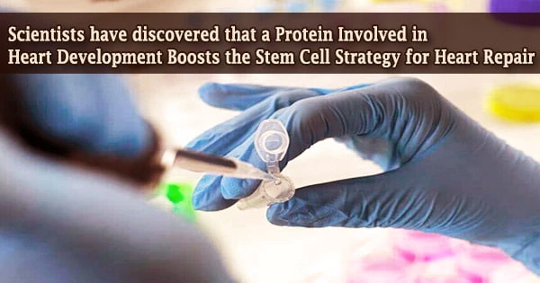 Scientists have discovered that a Protein Involved in Heart Development Boosts the Stem Cell Strategy for Heart Repair