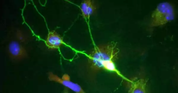 The Function of a Strange Structure Discovered on Neurons